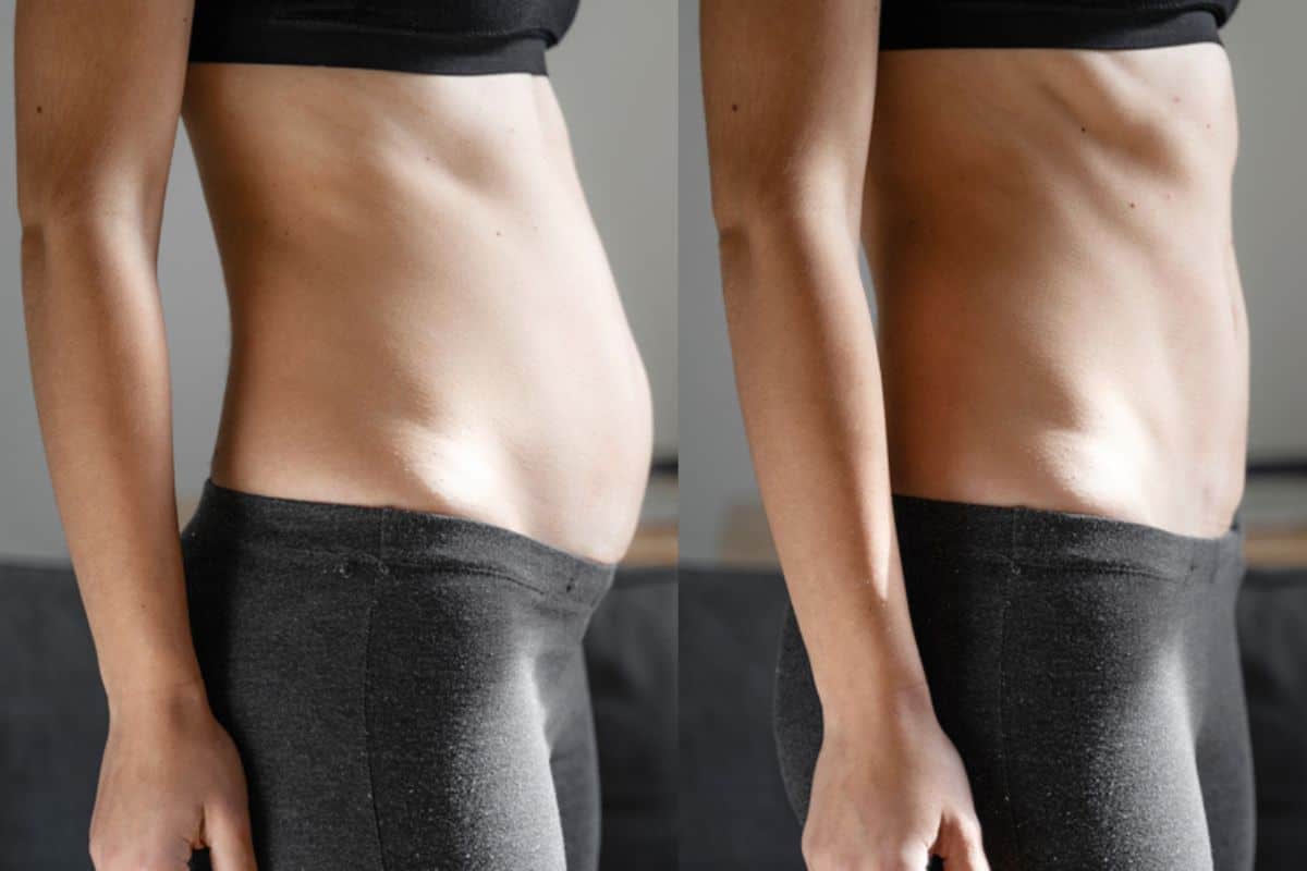 Post-Pregnancy: What Happens to Your Abdominal Muscles After Birth Bedford