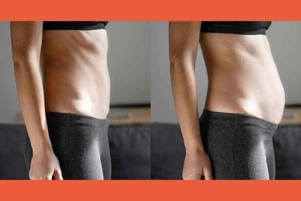 LA-EMS Body Sculpting results Bedford