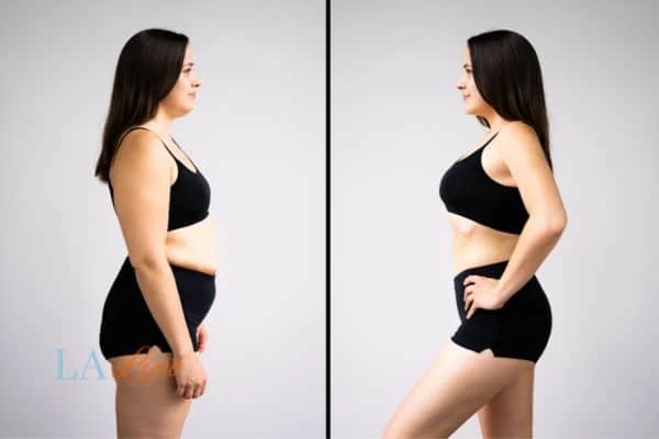 Picture of womans before and after using LA-EMS body sculpting to improve her core strength Bedford